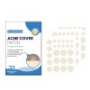 West & Month Acne Patch, Acne Acne Closed Mouth Smooth Skin Breathable Acne Patch